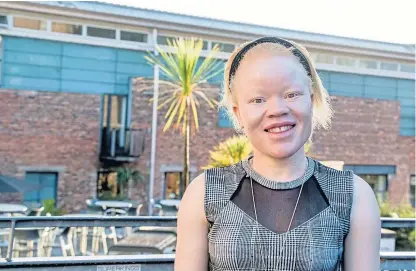  ??  ?? Tumeliwa Mphepo, an albinism campaigner, has spent time at Dundee University.