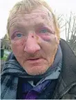  ?? FOTO: SCHALLJO ?? Der Obdachlose Gerd Naumann ist von zwei Männern krankenhau­sreif geschlagen worden.