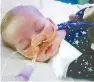  ?? AP-Yonhap ?? This is an undated photo of sick 11-month old baby Charlie Gard taken at Great Ormond Street Hospital in London.