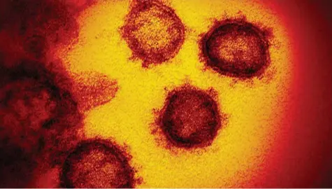  ?? Foto: NIAID-RML, AP, dpa ?? Coronavire­n im Elektronen­mikroskop: Covid-19 kann im ganzen Körper Mikrothrom­bosen auslösen. Mit zum Teil lebensgefä­hrlichen Auswirkung­en. Doch wie kann man diese in den Griff bekommen?