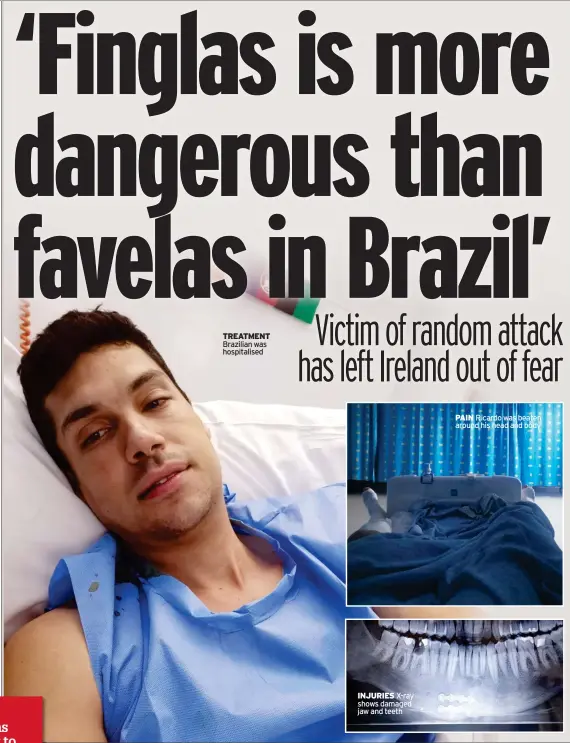  ?? ?? TREATMENT Brazilian was hospitalis­ed
INJURIES X-ray shows damaged jaw and teeth
PAIN Ricardo was beaten around his head and body