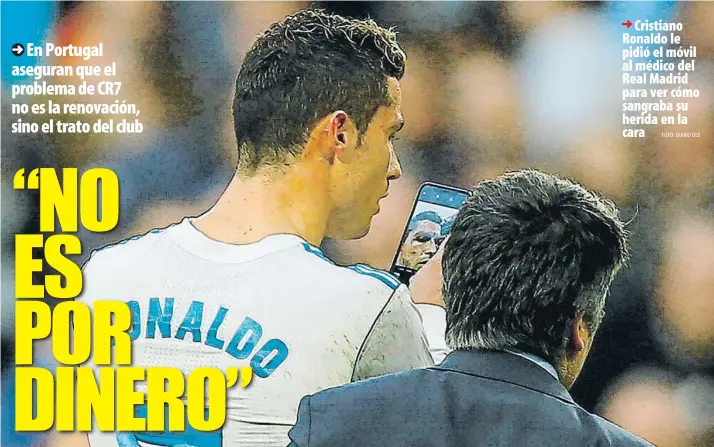  ?? FOTO: DIARIO OLÉ ?? Cristiano Ronaldo le pidió el móvil al médico del Real Madrid para ver cómo sangraba su herida en la cara