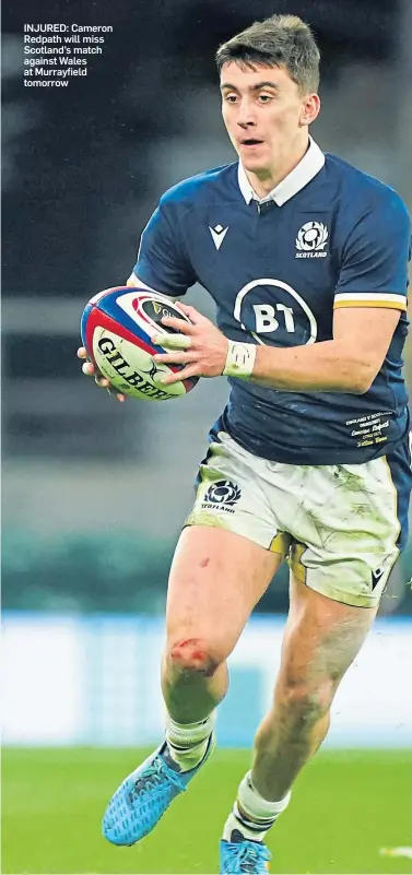  ??  ?? INJURED: Cameron Redpath will miss Scotland’s match against Wales at Murrayfiel­d tomorrow