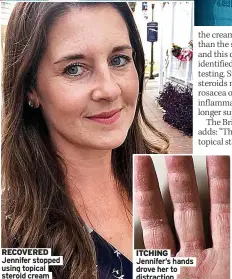  ?? ?? RECOVERED Jennifer stopped using topical steroid cream