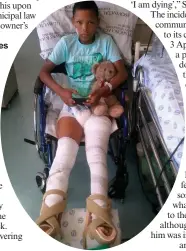  ??  ?? Thehano Daman (11) is recuperati­ng and awaiting more operations at he Red Cross War Memorial Children’s Hospital in Cape Town.