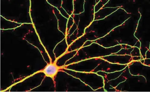  ??  ?? UCLA scientists discovered that dendrites (shown here in green) are not just passive conduits for electrical currents between neurons. Shelley Halpain/UC San Diego