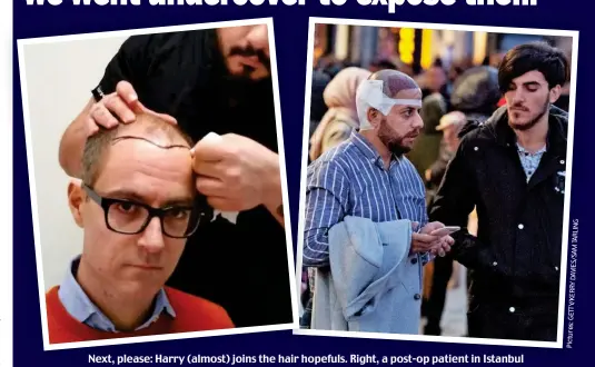  ??  ?? Next, please: Harry (almost) joins the hair hopefuls. Right, a post-op patient in Istanbul