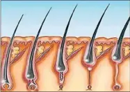  ??  ?? Una proteína restringe el crecimient­o de pelo en partes del cuerpo