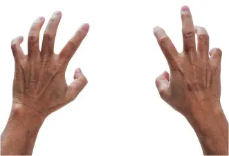  ?? FOTOLIA ?? A McGill study suggests men with short index fingers and long ring fingers tend to be nicer to women.