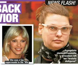  ?? ?? She was a top supermodel in the ’90s
Evangelist­a claimed a cosmetic procedure left her “brutally disfigured”