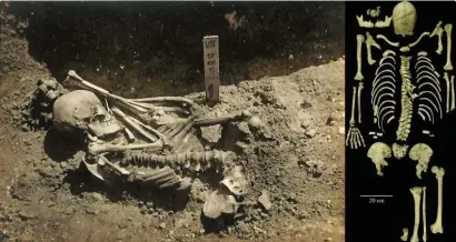  ?? COUrTEsy Of KyOTO UNivErsiTy ?? ANCIENT FIND: The original excavation photograph of a shark attack victim from 3,000 years ago, and a photograph of what’s left of the skeleton.