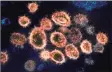  ?? NIAID-RML / Associated Press ?? An electron microscope image shows SARS-CoV-2 virus particles that cause COVID-19, isolated from a patient in the U.S., emerging from the surfaces of cells cultured in a lab.