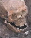  ??  ?? The skull of Richard III