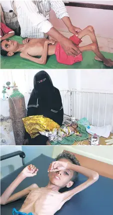  ?? Afp ?? DOLOROSO. Algunos de los niños yemeníes desnutrido­s por la falta de alimentos a causa de la guerra que lidera Arabia Saudita.