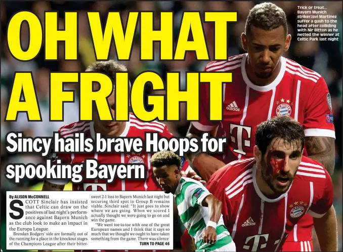  ??  ?? Trick or treat... Bayern Munich strikerJav­i Martinez suffer a gash to the head after colliding with Nir Bitton as he netted the winner at Celtic Park last night