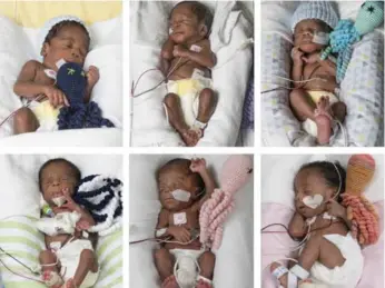  ?? ALLEN JONES/COURTESY OF VCU MEDICAL CENTER ?? Sextuplets — three boys and three girls — were delivered at 30 weeks to a couple in Richmond, Va., this month.