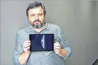  ?? ASSOCIATED PRESS ?? In this July 13 photo, Associated Press reporter Andrew Dalton holds an ipad displaying an image of his mammogram in downtown Los Angeles.