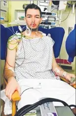  ??  ?? A 30% decrease in the size of the tumours on his liver has given Matt Burton hope of recovery after previously being told he had months to live