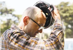  ??  ?? Sanford, who now wears a helmet when skateboard­ing, takes it off after, revealing a healing cracked skull. He also suffered cranial bleeding with symptoms that appeared months after the incident.