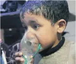  ??  ?? A child receives oxygen following an alleged poison-gas attack in the rebel-held town of Douma, near Damascus, Syria. Rescuers and medics said the attack killed at least 40 people.