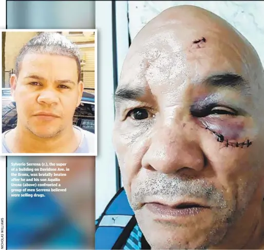  ??  ?? Sylverio Serrena (r.), the super of a building on Davidson Ave. in the Bronx, was brutally beaten after he and his son Aquilio Urena (above) confronted a group of men Serrena believed were selling drugs.