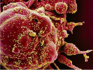  ?? NIH/Reuters ?? Célula infectada com partículas do novo coronavíru­s (em amarelo)
