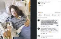  ?? ANGELA HERNANDEZ – FACEBOOK ?? Angela Hernandez posted photos of herself in the hospital after she was rescued from the bottom of a cliff along Highway 1 near Big Sur.
