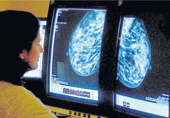  ??  ?? A consultant viewing a mammogram, the process of using low-energy X-rays to examine the human breast for diagnosis and screening.