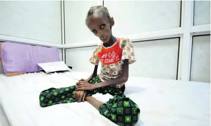  ?? Abduljabba­r Zeyad / Reuters ?? Saida Ahmad Baghili, 18, is just one of more than 14 million people in Yemen who are dealing with severe food shortages that have left the country on the brink of famine.