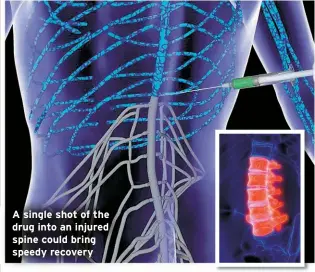  ?? ?? A single shot of the drug into an injured spine could bring speedy recovery