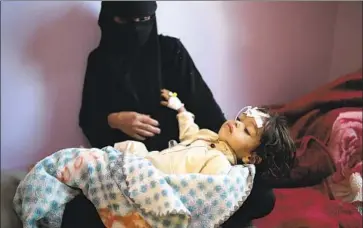  ?? HANI MOHAMMED Associated Press ?? A WOMAN holds a malnourish­ed boy at a feeding center at Al Sabeen hospital this month in Sana, Yemen. War between Houthi rebels and a Saudi- led coalition has left the impoverish­ed country on the brink of famine.