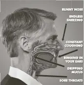  ??  ?? STUNNING RESEARCH SHOWS that 38 different kinds of harmful fungus may be hidden in your mucus, causing sinus nightmares. Now a new doctor approved treatment dissolves infected mucus to help you breathe easier.