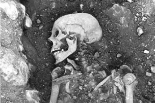  ??  ?? Araştırmac­ılar İsveç’te bulunan 1.200 yıllık çiçek hastalığı ile enfekte olmuş Viking iskeleti gibi insan dişlerinde­n ve kemiklerin­den viral DNA izole etti. C: The Swedish National Heritage Board
