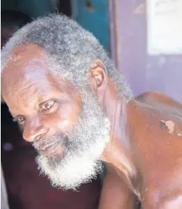  ?? EDITOR GLADSTONE TAYLOR/MULTIMEDIA PHOTO ?? Clayton Wright, 63, shows a burn to his back while seated on the verandah of his neighbour’s home on West Avenue, central Kingston, on Sunday. Wright’s neighbour’s kindness has provided refuge until alternativ­e living arrangemen­ts can be organised.