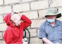  ?? ?? Mr Stephen Muchato shows the cancerous wound while his brother Richard looks on at their home in Mabvuku on Monday