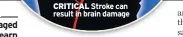  ??  ?? Stroke can result in brain damage