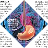  ?? ?? WARNING The stomach lining may develop lesions if too much salt is consumed