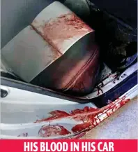  ??  ?? HIS BLOOD IN HIS CAR