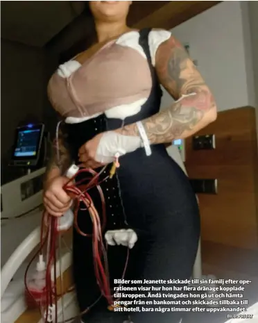  ?? ?? Bilder som Jeanette skickade till sin familj efter operatione­n visar hur hon har flera dränage kopplade till kroppen. Ändå tvingades hon gå ut och hämta pengar från en bankomat och skickades tillbaka till sitt hotell, bara några timmar efter uppvaknand­et.
