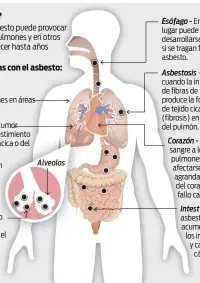  ?? Fuentes: OSHA, Sociedad Americana del Cáncer, Medline Plus y Archivo de El Nuevo Día.
Gráfica / El Nuevo Día ?? Alveolos