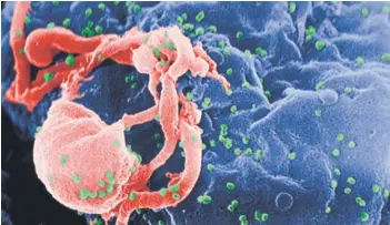  ??  ?? ► Imagen microscópi­ca del VIH, causante del sida.