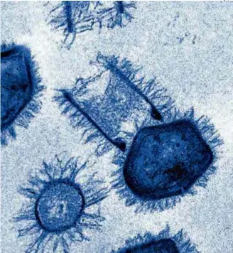  ?? Divulgação ?? Tupanvírus, em imagem de microscópi­o; partícula apresenta atípica cauda cilíndrica