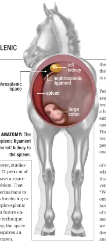  ??  ?? nephrosple­nic space left kidney nephrosple­nic ligament
spleen large colon