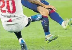  ?? FOTO: FCB ?? Los tacos rasgaron la media y alcanzaron la pierna derecha de Messi