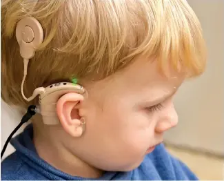  ??  ?? Research funded by the Elks of Saskatchew­an helped develop cochlear implants that are widely used to help children hear. (Getty Images)