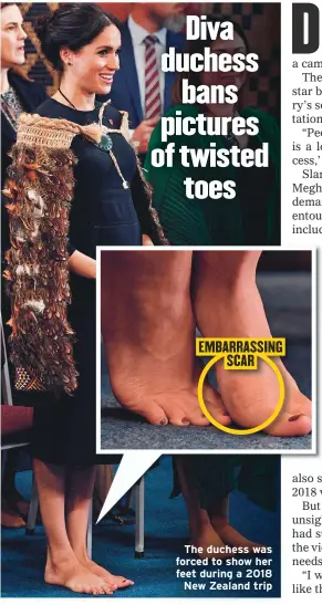  ??  ?? The duchess was forced to show her feet during a 2018 New Zealand trip