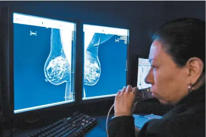  ??  ?? Estudios de neoplasias en los senos.