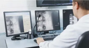  ??  ?? Un médecin analyse une radiograph­ie. - Archives