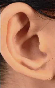  ?? Foto: imago ?? Wenn man nicht mehr gut hört, kann oft ein Cochlea Implantat helfen.