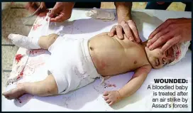  ??  ?? A bloodied baby is treated after an air strike by Assad’s forces WOUNDED: